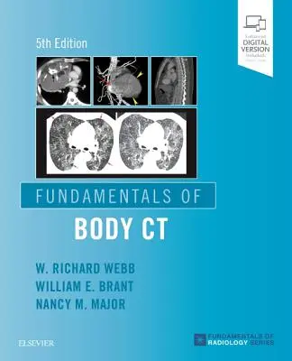 Bazele CT corporale - Fundamentals of Body CT