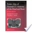 Atlas de buzunar al anatomiei CT normale a capului și creierului - Pocket Atlas of Normal CT Anatomy of the Head and Brain