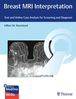 Interpretarea IRM a sânilor: Text și analiză de caz online pentru depistare și diagnosticare - Breast MRI Interpretation: Text and Online Case Analysis for Screening and Diagnosis