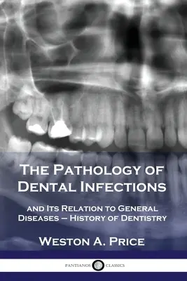 Patologia infecțiilor dentare: și relația sa cu bolile generale - Istoria stomatologiei - The Pathology of Dental Infections: and Its Relation to General Diseases - History of Dentistry