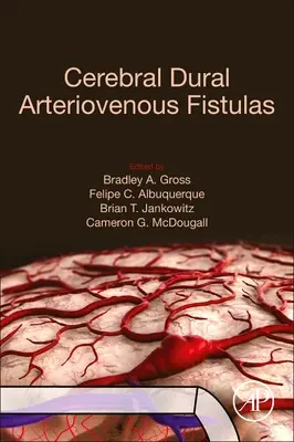Fistulele arteriovenoase durale cerebrale - Cerebral Dural Arteriovenous Fistulas