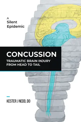 Contuzii: Leziuni cerebrale traumatice de la cap la coadă - Concussion: Traumatic Brain Injury from Head to Tail