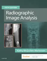 Analiza imaginilor radiografice - Radiographic Image Analysis
