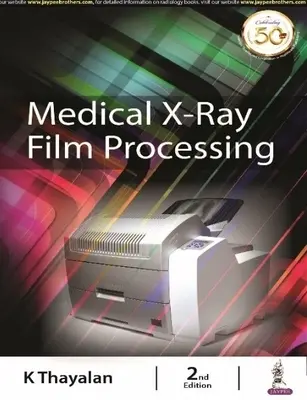 Procesarea filmelor medicale cu raze X - Medical X-ray Film Processing