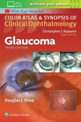 Glaucom - Glaucoma