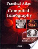 Atlas practic de tomografie computerizată - Practical Atlas of Computed Tomography