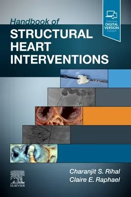 Manual de intervenții cardiace structurale - Handbook of Structural Heart Interventions