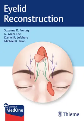 Reconstrucția pleoapelor - Eyelid Reconstruction