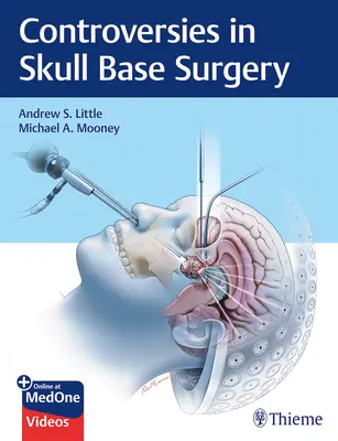 Controverse în chirurgia bazei craniului - Controversies in Skull Base Surgery