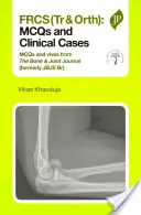 Frcs(tr & Orth): McQs și cazuri clinice - Frcs(tr & Orth): McQs and Clinical Cases