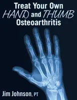 Tratați-vă singur osteoartrita mâinii și a degetului mare - Treat Your Own Hand and Thumb Osteoarthritis
