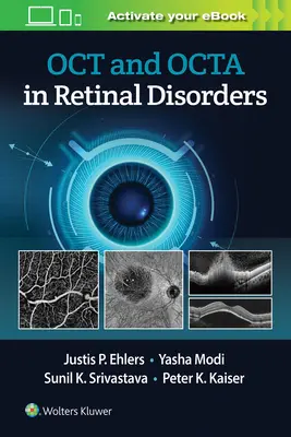 Oct și Octa în tulburările de retină - Oct and Octa in Retinal Disorders