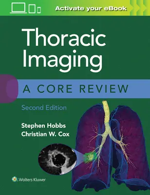 Imagistica toracică: O revizuire de bază - Thoracic Imaging: A Core Review