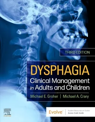 Disfagia - Management clinic la adulți și copii - Dysphagia - Clinical Management in Adults and Children