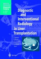Radiologie diagnostică și intervențională în transplantul hepatic - Diagnostic and Interventional Radiology in Liver Transplantation