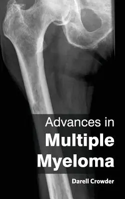 Avansuri în mielomul multiplu - Advances in Multiple Myeloma