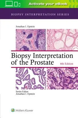 Interpretarea biopsiei de prostată - Biopsy Interpretation of the Prostate