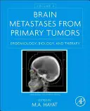 Metastazele cerebrale din tumorile primare, volumul 2: Epidemiologie, biologie și terapie - Brain Metastases from Primary Tumors, Volume 2: Epidemiology, Biology, and Therapy