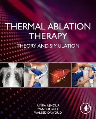 Terapia prin ablație termică: Teorie și simulare - Thermal Ablation Therapy: Theory and Simulation