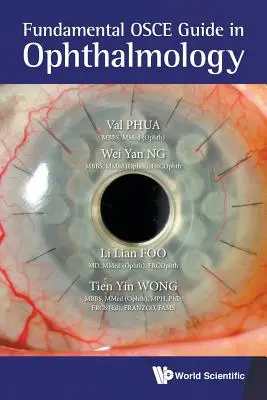 Ghidul OSCE fundamental în oftalmologie - Fundamental OSCE Guide in Ophthalmology