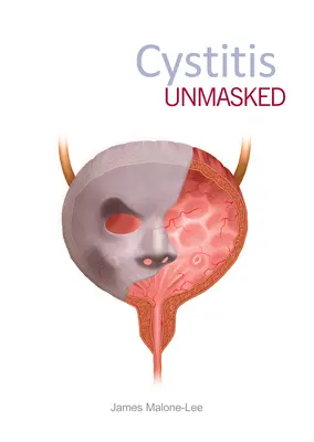 Cistita demascată - Cystitis Unmasked