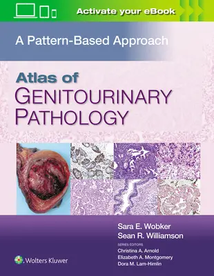 Atlas de patologie genito-urinară: O abordare bazată pe modele - Atlas of Genitourinary Pathology: A Pattern Based Approach