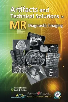 Artefacte și soluții tehnice în imagistica de diagnostic RM - Artifacts and Technical Solutions in MR Diagnostic Imaging