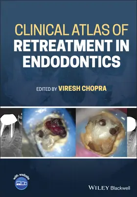 Atlas clinic de retratare în endodonție - Clinical Atlas of Retreatment in Endodontics