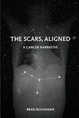 Cicatricile, aliniate - The Scars, Aligned