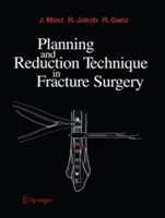 Tehnica de planificare și reducere în chirurgia fracturilor - Planning and Reduction Technique in Fracture Surgery