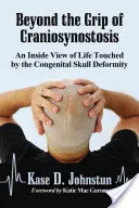 Dincolo de strânsoarea craniosinostozei: O privire din interior asupra vieții afectate de o malformație congenitală a craniului - Beyond the Grip of Craniosynostosis: An Inside View of Life Touched by the Congenital Skull Deformity