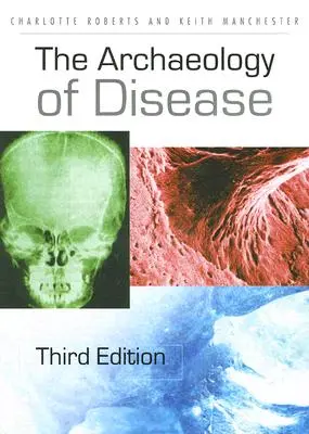Arheologia bolilor - The Archaeology of Disease