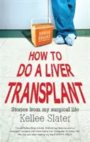 Cum să faci un transplant de ficat: Povestiri din viața mea chirurgicală - How to do a liver transplant: Stories from my surgical life