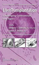 Transplantul hepatic: Controverse și subiecte provocatoare: Challenging Controversies and Topics - Liver Transplantation: Challenging Controversies and Topics