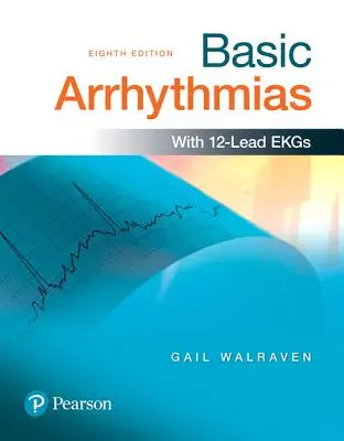Aritmii de bază - Basic Arrhythmias