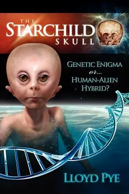 Craniul Starchild - Enigmă genetică sau hibrid uman-alian? - The Starchild Skull -- Genetic Enigma or Human-Alien Hybrid?