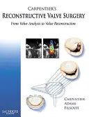 Carpentier's Reconstructive Valve Surgery: De la analiza valvei la reconstrucția valvei - Carpentier's Reconstructive Valve Surgery: From Valve Analysis to Valve Reconstruction