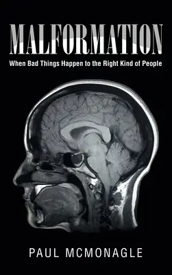 Malformații: Când lucrurile rele se întâmplă oamenilor potriviți - Malformation: When Bad Things Happen to the Right Kind of People