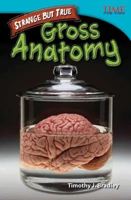 Ciudat dar adevărat: Anatomie brută - Strange but True: Gross Anatomy