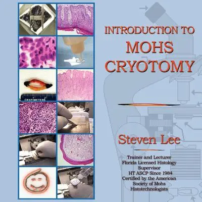 Introducere în criotomia MOHS - Introduction to MOHS Cryotomy
