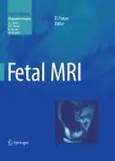 RMN fetal - Fetal MRI
