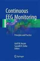 Monitorizarea continuă a Eeg: Principii și practică - Continuous Eeg Monitoring: Principles and Practice