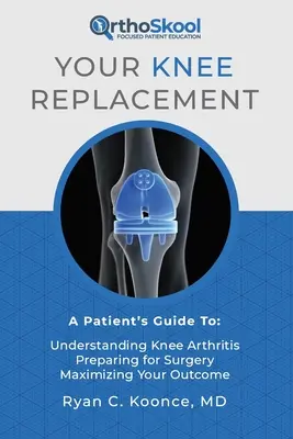 Înlocuirea genunchiului dumneavoastră: Ghidul pacientului pentru: Înțelegerea artritei genunchiului, Pregătirea pentru operație, Maximizarea rezultatului - Your Knee Replacement: A Patient's Guide To: Understanding Knee Arthritis, Preparing for Surgery, Maximizing Your Outcome