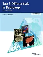 Top 3 diferențiale în radiologie: O analiză de caz - Top 3 Differentials in Radiology: A Case Review