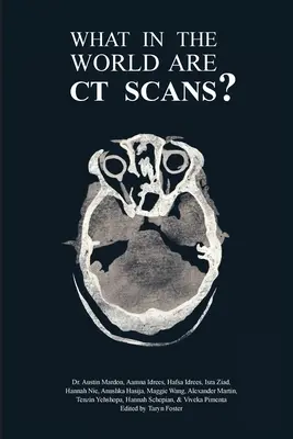 Ce naiba sunt scanările CT? - What in the World are CT Scans?