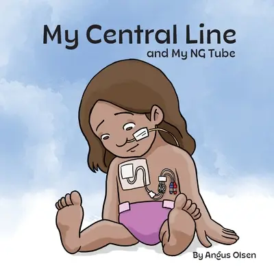 Linia mea centrală și tubul meu NG - My Central Line and My NG Tube
