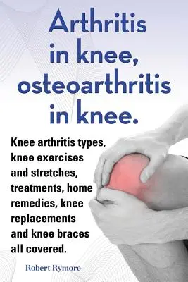 Artrita în genunchi, osteoartrita în genunchi. Tipuri de artrită la genunchi, exerciții și întinderi la genunchi, tratamente, remedii la domiciliu, înlocuiri de genunchi și b - Arthritis in knee, osteoarthritis in knee. Knee arthritis types, knee exercises and stretches, treatments, home remedies, knee replacements and knee b
