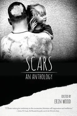 Cicatrici: O antologie - Scars: An Anthology