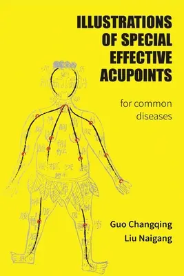 Ilustrations Of Special Effective Acupoints for common Diseases - Illustrations Of Special Effective Acupoints for common Diseases