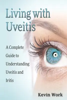 Trăind cu uveita: Un ghid complet pentru uveită și irită - Living with Uveitis: A Complete Guide to Uveitis and Iritis